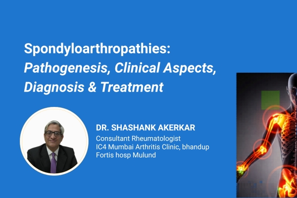 Spondyloarthropathies: Pathogenesis, Clinical Aspects, Diagnosis & Treatment