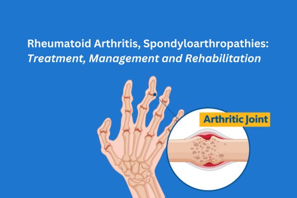 Rheumatoid Arthritis & Spondyloarthropathies: Management, Treatment & Rehabilitation
